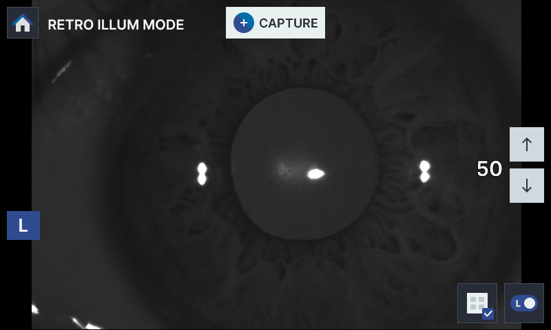 HRK-8100A anterior segment analysis with retro-illumination and color view modes