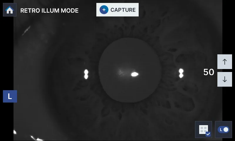 HRK-8100A anterior segment analysis with retro-illumination and color view modes