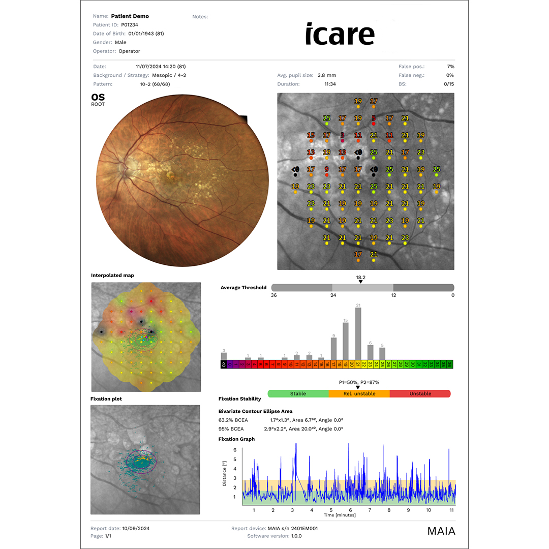 iCare MAIA examination report with sensitivity and fixation data